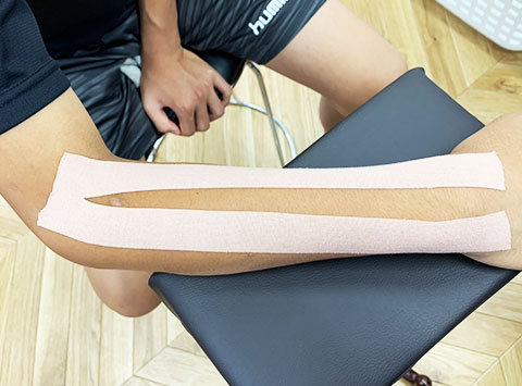 キネシオテーピング